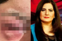 Journalist Jasmeen Manzoor Accuses Ex-Husband of Domestic Violence