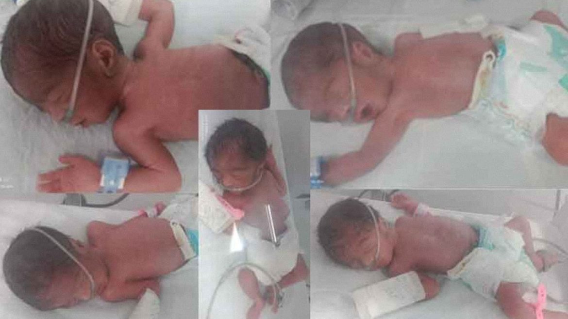 Miracle in Karachi: Woman Gives Birth to Quintuplets.