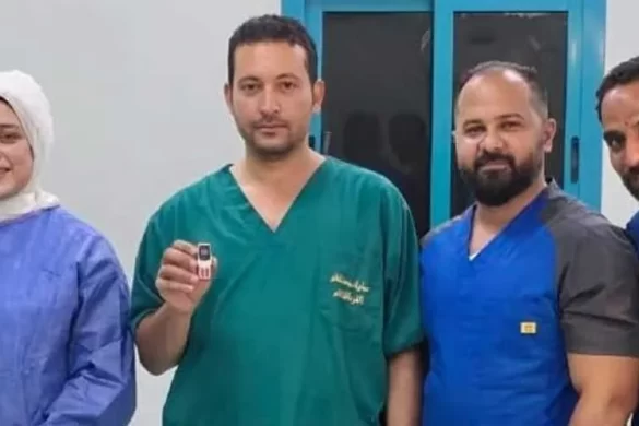 Egyptian Doctors Remove Mobile Phone from Man’s Stomach in Rare Surgery