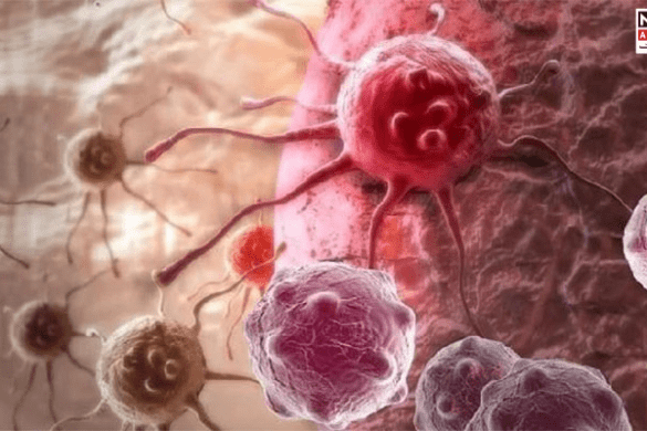 Six Common Foods That May Increase Your Cancer Risk