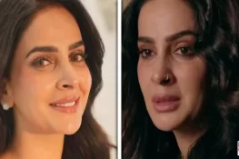 Saba Qamar’s Lip Transformation Sparks Social Media Buzz: Surgery or Fillers?