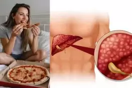 Late-Night Eating Linked to World’s Most Common Liver Disease, Study Finds