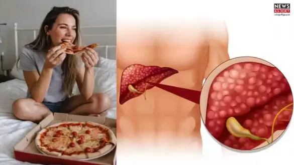 Late-Night Eating Linked to World’s Most Common Liver Disease, Study Finds