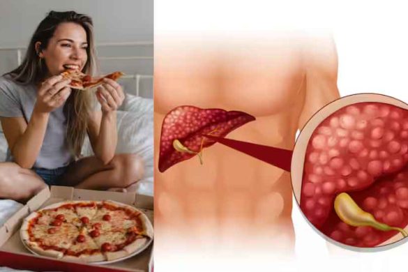 Late-Night Eating Linked to World’s Most Common Liver Disease, Study Finds