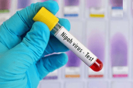 Pakistan Strengthens Preparedness Against Nipah Virus, Secures Testing Kits