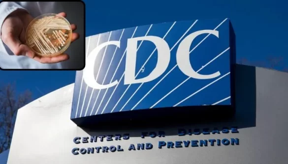 Drug-Resistant Candida auris Fungus Infects More Than 3,100 People Across US