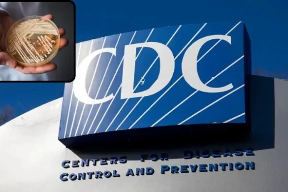 Drug-Resistant Candida auris Fungus Infects More Than 3,100 People Across US