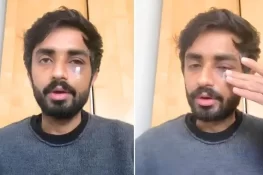 Pakistani Student Suffers Facial Fractures in Glasgow Racist Attack