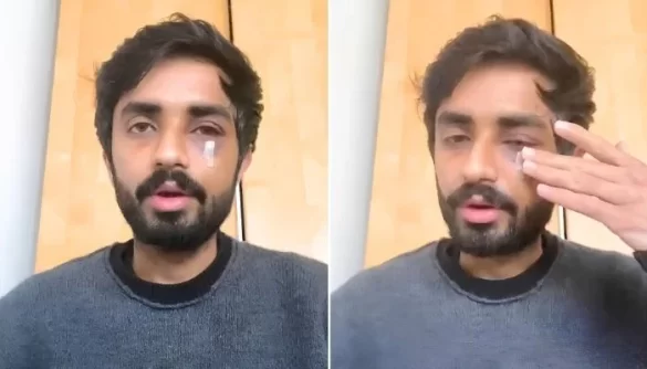 Pakistani Student Suffers Facial Fractures in Glasgow Racist Attack