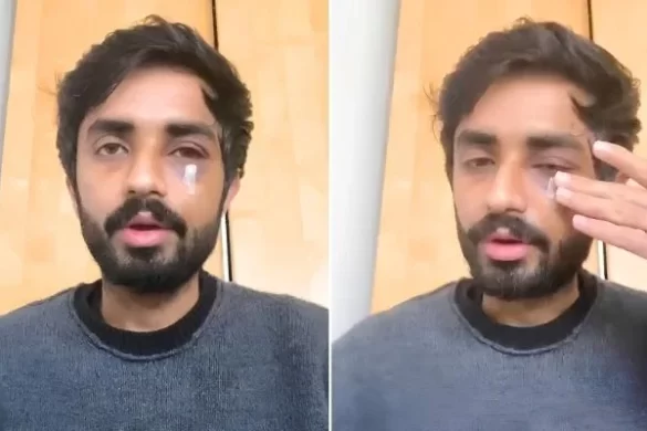 Pakistani Student Suffers Facial Fractures in Glasgow Racist Attack