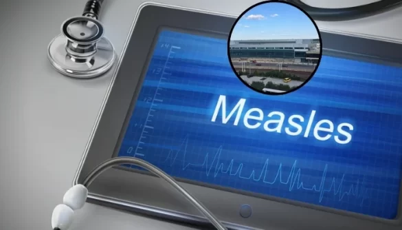 Measles exposure alert issued after case detected at Philadelphia airport