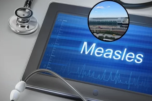 Measles exposure alert issued after case detected at Philadelphia airport